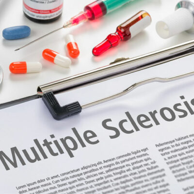 Multiple Sclerosis – Causes and Early Warning Signs